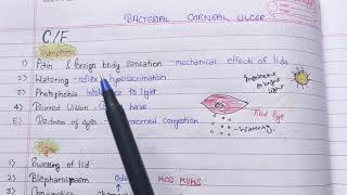 Keratitis Part 2 bacterial corneal ulcer theory notes  AK KHURANA [upl. by Luttrell]