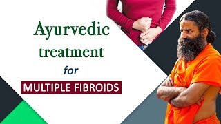 What are Fibroids its diagnosis amp management  Dr B Ramesh [upl. by Eytteb]