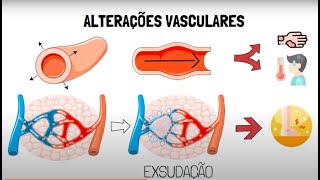 Inflamação Aguda [upl. by Allemaj219]