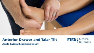 Anterior Drawer and Talar Tilt  Ankle Lateral Ligament Injury [upl. by Nylhsoj723]