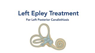 At Home Left Epley Maneuver for BPPV Vertigo [upl. by Oicul]