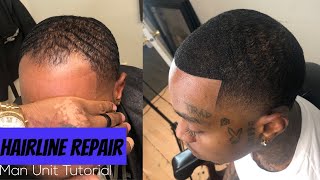 SHOCKING TRANSFORMATION Must see Hairline Repair Service  Best Man Unit Tutorial [upl. by Convery936]