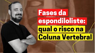 Fases da espondiloliste qual o risco na Coluna Vertebral  José Góes [upl. by Elletnahc]