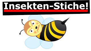 Hilfe bei Bienenstich  Bienenstiche behandeln [upl. by Acessej]