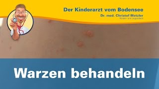 Warzen behandeln  Der Kinderarzt vom Bodensee Warzen 22 [upl. by Jennine]