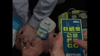 AED Plus Trainer 2 [upl. by Nicolle266]