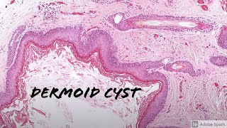 Histology of lymph node [upl. by Neladgam]