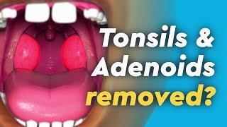 Tonsil and Adenoid Anatomy [upl. by Kennett]