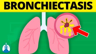 Bronchiectasis Medical Definition  Quick Explainer Video [upl. by Leavy614]