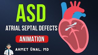 Device Closure of Atrial Septal Defect ASD [upl. by Ahseram]