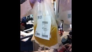 The Truth About Plasma Donation and Side Effects [upl. by Enelehs295]