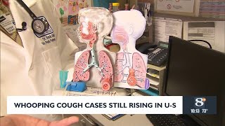 Whooping Cough Cases Still Rising in US [upl. by Llerehc230]