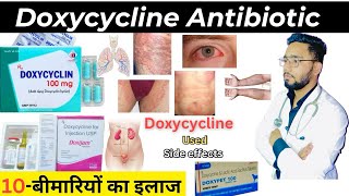 Doxycycline  एंटीबायोटिक  Medicine  Treatment  Antibiotics  doxycycline medicine Used [upl. by Ahser]