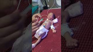 Feeding tube insertion procedure in newborn baby 🐥🍼😍medico youtubeshort viralvideo [upl. by Enala]