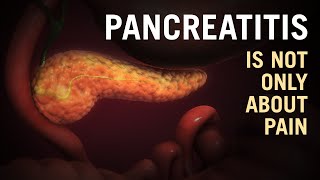 Pancreatitis  Is it a killer disease Dr Purnendu Roy explains  MS FICS FAISDUROLLON [upl. by Salem]