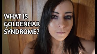 What is Goldenhar Syndrome [upl. by Nibur770]