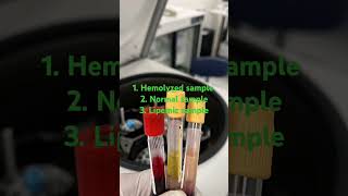 Difference between normal  hemolyzed and lipemic sample labinfo2 science facts shorts short [upl. by Jaal956]