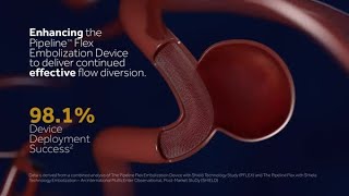 Pipeline Flex with Shield Technology – Shielded by Science [upl. by Enileoj]