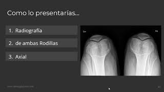 Como Presentar una Radiografia [upl. by Theone]