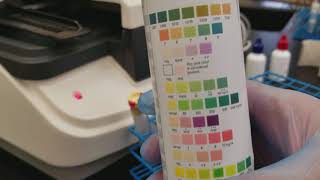 Urinalysis Performing QC on the Criterion II [upl. by Landa]