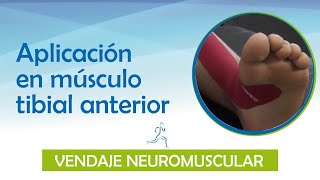 VENDAJE NEUROMUSCULAR  ¿Sabes como se aplica el vendaje en el tibial anterior acá te enseñamos [upl. by Nnairret]