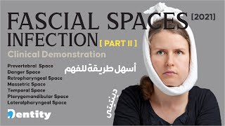 شرح مبسط  Fascial Spaces Infection  PART 22 [upl. by Amos]