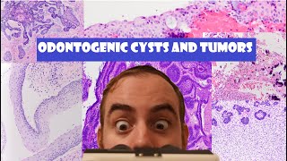 The ULTIMATE Odontogenic Cyst and Tumor Review Video [upl. by Napas]