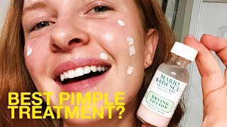 Best Pimple Spot Treatment I Try Mario Badescu Drying Lotion [upl. by Orihakat]