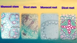 To identify histology among microscopic view of dicot root monocot root dicot stem monocot stem [upl. by Anitsyrhk547]