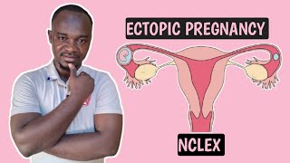 ECTOPIC PREGNANCY for nurses and all NCLEX student [upl. by Natloz216]