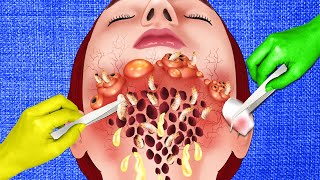 ASMR Girl with a hole wound in her neck  ASMR Animation [upl. by Jedlicka]