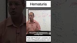 Hematuria shortvideo shorts drnajeeb drnajeeblectures [upl. by Aisatsan545]