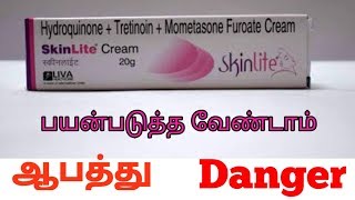 Skinlite  skin lite பக்க விளைவு Side effect TAMIL REVIEW [upl. by Blinnie270]