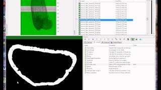 Bruker microCT tutorial Cortical bone morphometry part 1 periosteal and endosteal envelopes [upl. by Rez]