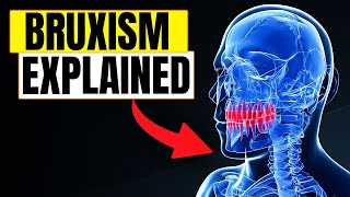 Bruxism Explained  How To Stop Teeth Grinding amp Sleep Health Issues of Bruxism [upl. by Aneerol]