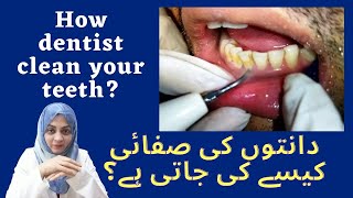 Dental Scaling Live Demo  Teeth Cleaning  Danto ki safai [upl. by Hauser961]