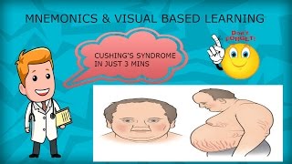 Cushing Syndrome Pathophysiology VLearning™  1500 Medical Videos on sqadiacom [upl. by Nwahsan]