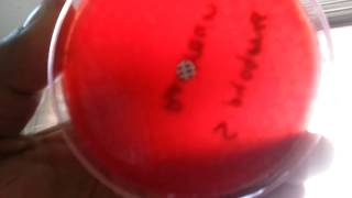 Bacitracin test for Streptococcus pyogenes [upl. by Demeter]