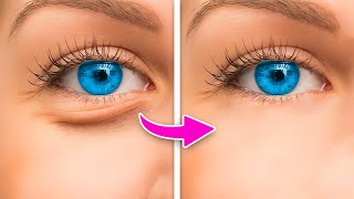 HOW TO MAKE UNDER EYE BAGS DISAPPEAR IN SECONDS [upl. by Cullin]