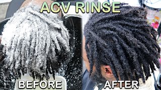 My First ACV RINSE on DREADLOCKS  How To WASH LOCS Starter Locs Journey [upl. by Valerlan]