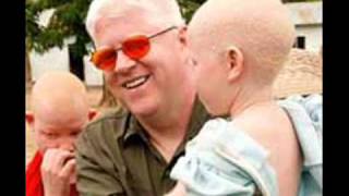 Albinos In Africa Killed For Their Organs  1 [upl. by Laehcor]