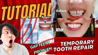 Tutorial How to use Moldable False teeth [upl. by Ashly]