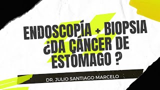 Biopsia en la endoscopía y cáncer de estómago [upl. by Bathsheeb]