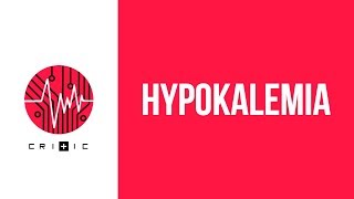 Hypokalemia  an easy workup [upl. by Ginder]