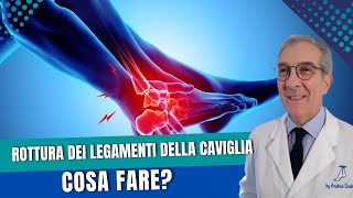 Rottura dei legamenti della caviglia cosa fare  Lesione legamenti e Artrosi  Dott Andrea Scala [upl. by Nueoht108]