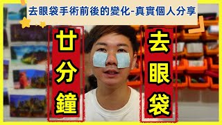 【去眼袋手術前後的變化真實故事分享】只需做一次｜二十分鐘完成｜去眼袋療程｜過程｜感受｜保養｜痛唔痛｜去眼袋手術｜醫學微創｜眼袋槍ZAKI 體驗 [upl. by Housum]