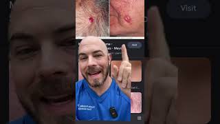 Dermatologist explains Merkel cell carcinoma that Jimmy Buffett died from dermreacts jimmybuffett [upl. by Eiuol]