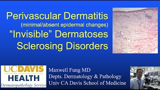 DERMATOPATHOLOGY Perivascular Dermatitis Invisible Dermatoses Fibrosing amp Sclerosing Disorders [upl. by Elatnahs357]