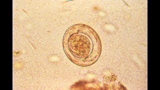 Hymenolepis nana The dwarf tapeworm [upl. by Htebesile722]