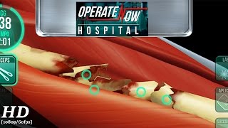 Operate Now Hospital Android Gameplay 1080p60fps [upl. by Nyleve872]